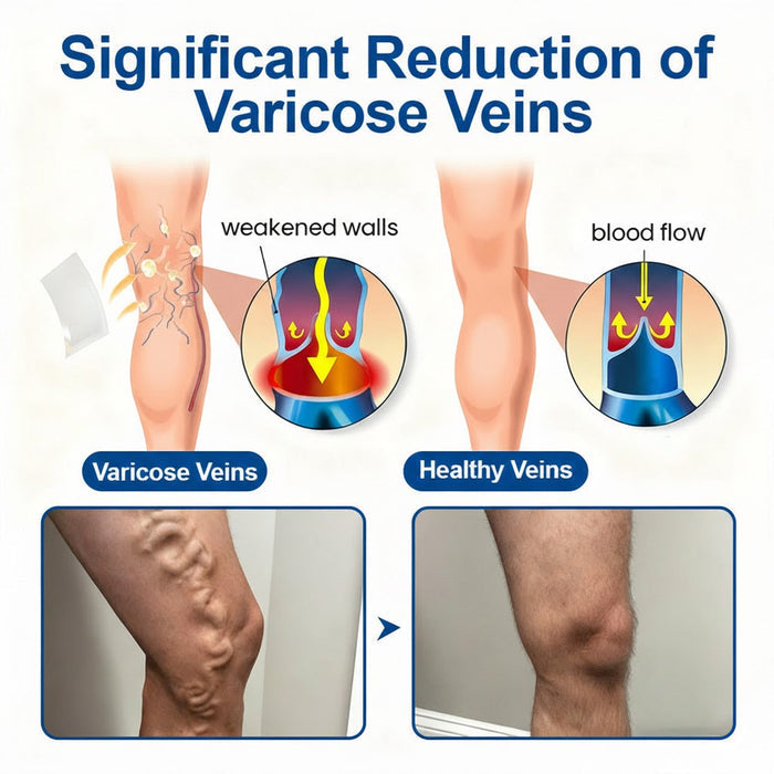 🇺🇸 🥰GFOUK® VeinEase Microneedle Care Patch⚡Instant Relief, Long-Term Results