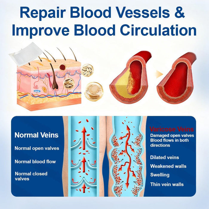 🇺🇸 🥰GFOUK® VeinEase Microneedle Care Patch⚡Instant Relief, Long-Term Results